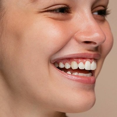 Dental Tooth Bonding & Cementing in Dubai Composite Tooth Cost