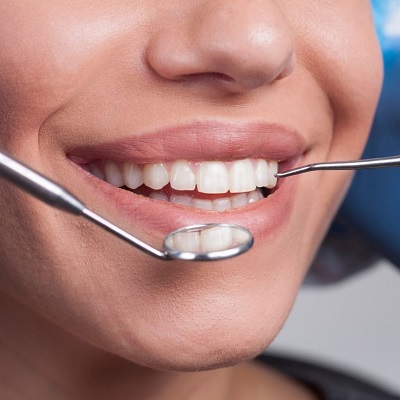 Does Scaling and Polishing Whiten Teeth?