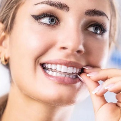 What Are the Different Types of Retainers for Teeth?